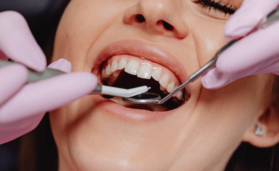 Addressing Specific Dental Concerns